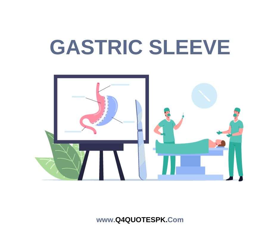 bmi for gastric sleeve